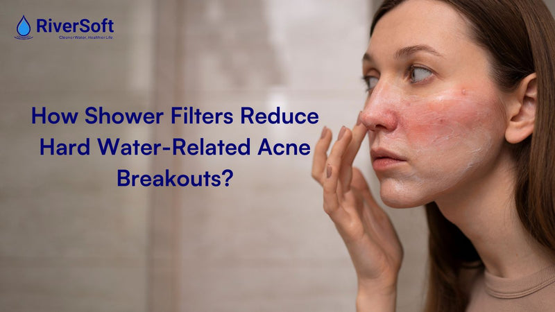 Does Hard Water Cause Acne? How Shower Filters Help in 2026