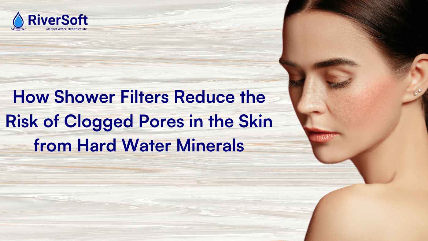 How Shower Filters Reduce the Risk of Clogged Pores in the Skin from Hard Water Minerals